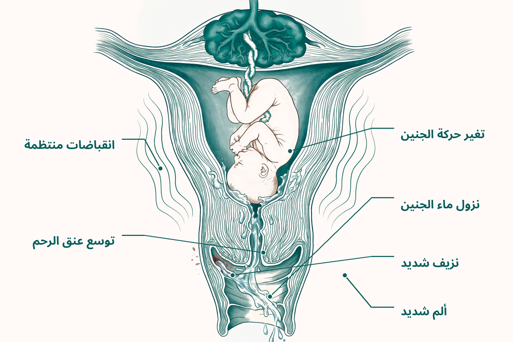 رسم توضيحي دليل الحمل والولادة يوضح علامات الولادة والعلامات التي تستدعي الرعاية العاجلة